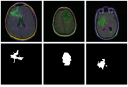 Brain image segmentation with torch